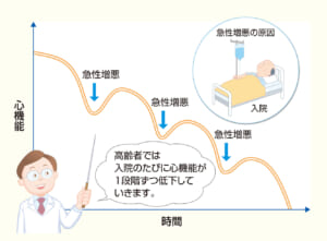 心不全における心機能低下のイメージ